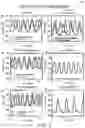 Fig. 17 - Three-dimensional microtissues with integrated mechanical loading