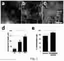 Fig. 04 - Method of human periferic sensory neurons differenciation from human stem cells and uses thereof