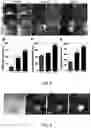 Fig. 05 - Method of human periferic sensory neurons differenciation from human stem cells and uses thereof