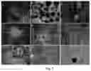 Fig. 02 - Method of obtaining pigmented cells in vitro by the differentiation of human induced pluripotent stem cells