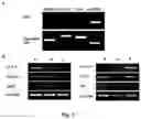 Fig. 04 - Method of obtaining pigmented cells in vitro by the differentiation of human induced pluripotent stem cells
