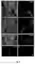 Fig. 05 - Method of obtaining pigmented cells in vitro by the differentiation of human induced pluripotent stem cells