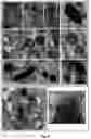 Fig. 06 - Method of obtaining pigmented cells in vitro by the differentiation of human induced pluripotent stem cells