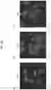 Fig. 31 - Method for producing platelets