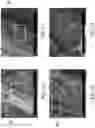 Fig. 07 - BIOLOGIC SAMPLE COLLECTION DEVICES AND METHODS OF PRODUCTION AND USE THEREOF