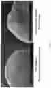 Fig. 14 - BIOLOGIC SAMPLE COLLECTION DEVICES AND METHODS OF PRODUCTION AND USE THEREOF