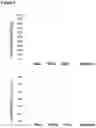 Fig. 05 - Methods and compositions for extracting nucleic acids using ferric oxide particles