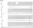 Fig. 12 - Systems and methods for treating alpha 1-antitrypsin (A1AT) deficiency