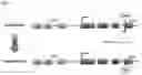 Fig. 35 - Systems and methods for treating alpha 1-antitrypsin (A1AT) deficiency