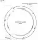 Fig. 52 - Systems and methods for treating alpha 1-antitrypsin (A1AT) deficiency