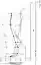 Fig. 11 - SERPINC1 iRNA COMPOSITIONS AND METHODS OF USE THEREOF