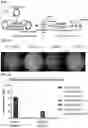 Fig. 02 - Splice inhibiting oligonucleotides