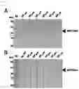 Fig. 04 - Recombinant PETase producing strain, recombinant MHETase producing strain, and composition for degrading PET containing the same
