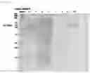 Fig. 06 - Recombinant PETase producing strain, recombinant MHETase producing strain, and composition for degrading PET containing the same