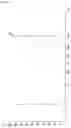Fig. 47 - METHOD FOR PRODUCING DNA PROBE AND METHOD FOR ANALYZING GENOMIC DNA USING THE DNA PROBE