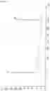 Fig. 88 - METHOD FOR PRODUCING DNA PROBE AND METHOD FOR ANALYZING GENOMIC DNA USING THE DNA PROBE