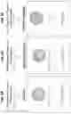 Fig. 07 - Spatial indexing of genetic material and library preparation using hydrogel beads and flow cells