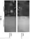Fig. 20 - Spatial indexing of genetic material and library preparation using hydrogel beads and flow cells