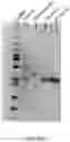 Fig. 72 - Methods and systems for processing polynucleotides