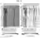 Fig. 34 - Diagnostic methods for infectious disease using endogenous gene expression