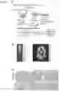 Fig. 02 - METHOD FOR SUPPRESSING BRAIN METASTASIS