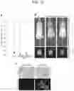 Fig. 13 - METHOD FOR SUPPRESSING BRAIN METASTASIS
