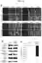 Fig. 19 - METHOD FOR SUPPRESSING BRAIN METASTASIS