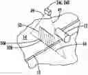 Fig. 01 - Determining milled volume or milled area of a milled surface