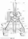 Fig. 03 - Systems, methods and machines for driving screw anchors