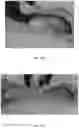 Fig. 22 - COLLAPSIBLE TENT STRUCTURE