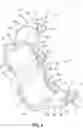 Fig. 04 - Bend restrictors