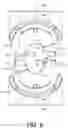 Fig. 07 - Hang off ram preventer