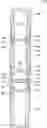 Fig. 01 - Downhole assembly for selectively sealing off a wellbore