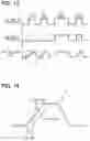 Fig. 11 - Electronic control unit