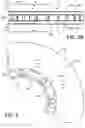 Fig. 12 - Air cooling of disc brake unit by longitudinal vortex generator