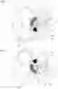 Fig. 03 - Assembly having a first chamber and at least one second chamber
