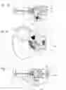 Fig. 08 - Assembly having a first chamber and at least one second chamber