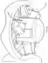 Fig. 35 - Firearm bipod