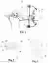 Fig. 02 - Bowmar nose button