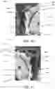 Fig. 07 - SHARP IMPLEMENT THROWING TARGET