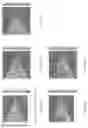 Fig. 41 - Apparatus and methods for mirror tunnel imaging device and for providing pseudobessel beams in a miniaturized optical system for imaging