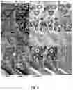 Fig. 06 - Infrared-optical hybrid imaging technology for all-digital histopathology