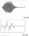 Fig. 26 - Ultrasonic flow meter with subsampling of ultrasonic transducer signals