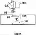 Fig. 08 - Method for bone scan in meat