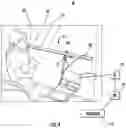 Fig. 05 - Method a System for a Biomarker Breath Test Using Mass Abnormalities in Gaseous Ions with Imaging Correlates