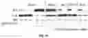 Fig. 06 - Biomarkers of organic acidemias