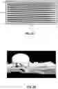 Fig. 04 - Lidar system including multifaceted deflector