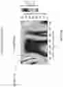 Fig. 09 - Low contrast anti-reflection articles with reduced scratch and fingerprint visibility