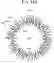 Fig. 10 - CONTACT LENS WITH IMPROVED, MULTIPLE AND INTEGRATED EFFECTS