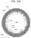 Fig. 11 - CONTACT LENS WITH IMPROVED, MULTIPLE AND INTEGRATED EFFECTS